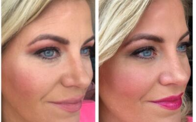 Cleanse, Extract, Hydrate with our Illuminating HydraFacial!  Enjoy a gift with purchase!