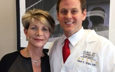 Facelift Video Testimonial