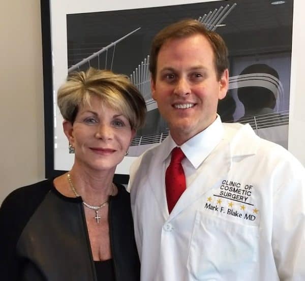 Facelift Video Testimonial