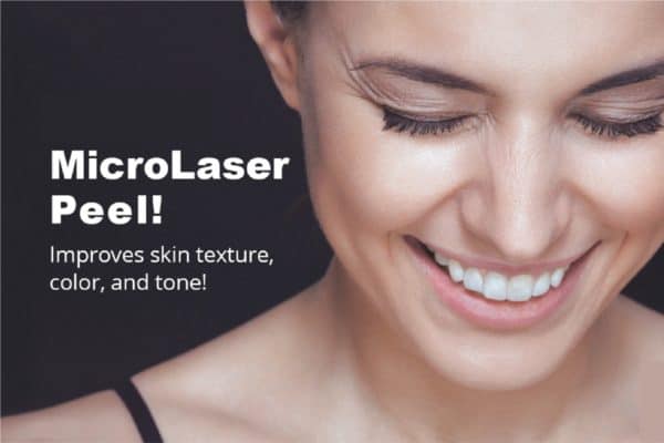 MicroLaser peel graphic with woman smiling