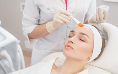 Top 10 Benefits of Chemical Peels