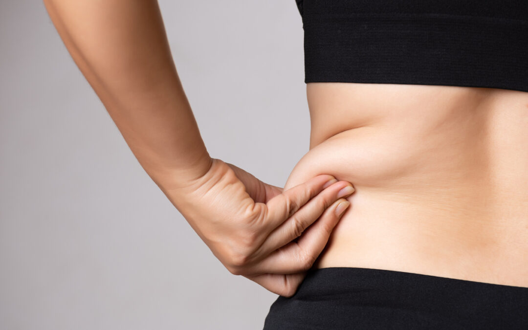 Removing Fat Through Liposuction